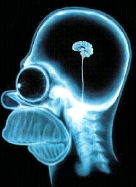 [HomerBrain.jpg]
Homer's brain xray